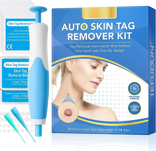 Fjerning av Leverflekker - Bli kvitt fødselsmerker og Skintags